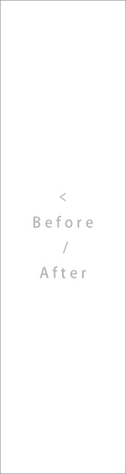 < Befor / After